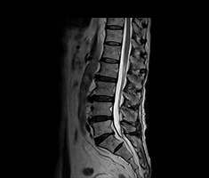 腰椎：ヘルニア、脊柱管狭窄、圧迫骨折などの検査。